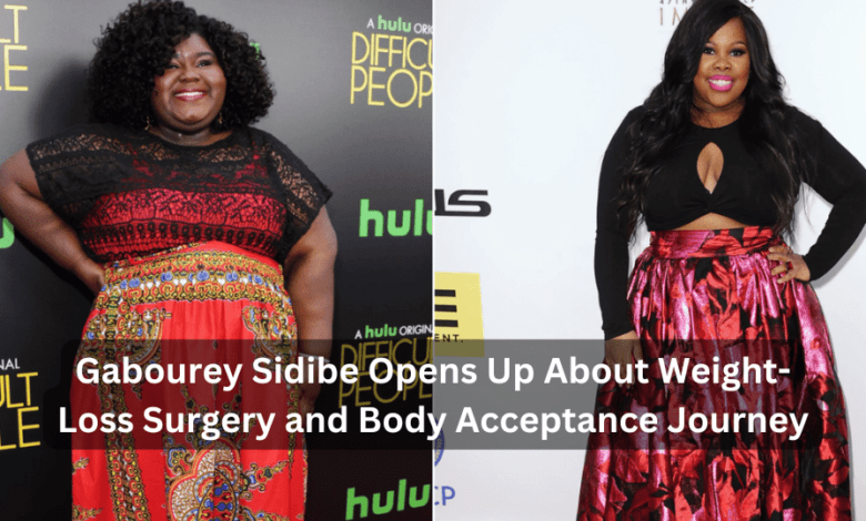 Gabourey Sidibe Opens Up About Weight-Loss Surgery and Body Acceptance Journey